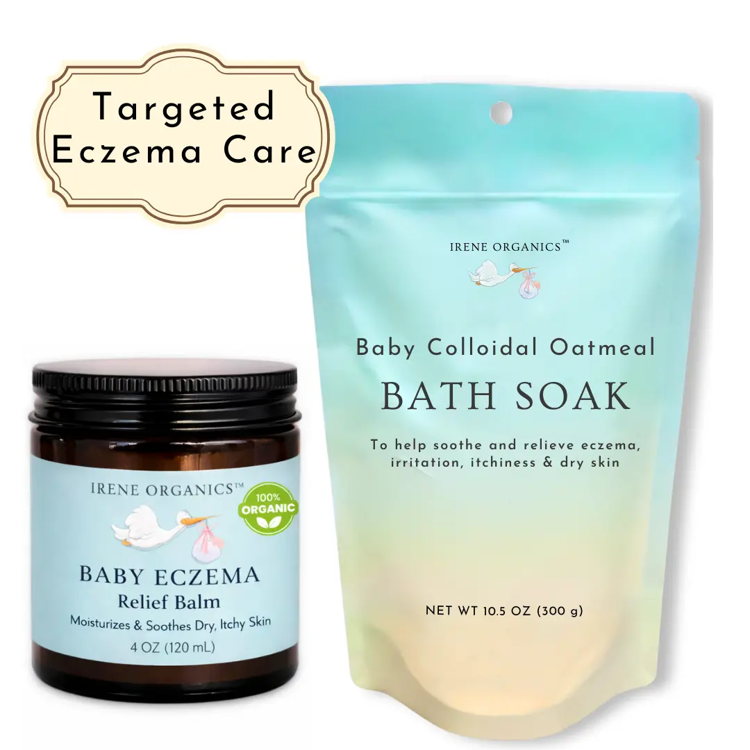 Irene Organics Baby Eczema Relief Bundle 1